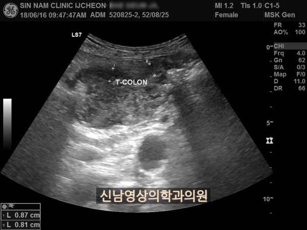 c521c0b12f3852411610eac7ec2d1b79_1757374